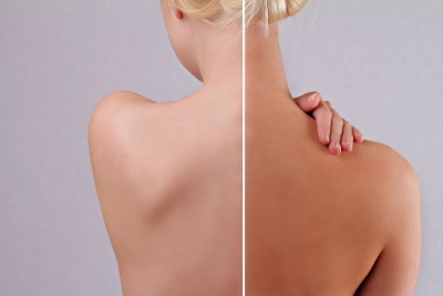 Capacitación en Diferentes Tipos de Bronceados sin Sol