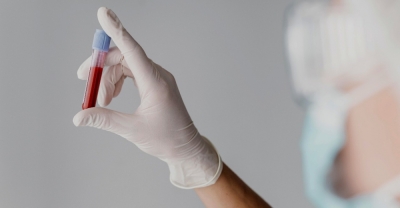 Patología Hemostática y trastornos de la coagulación + ...
